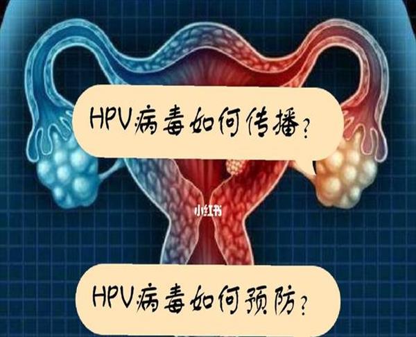 口腔感染hpv如何自测(女性hpv52阳性普遍吗)